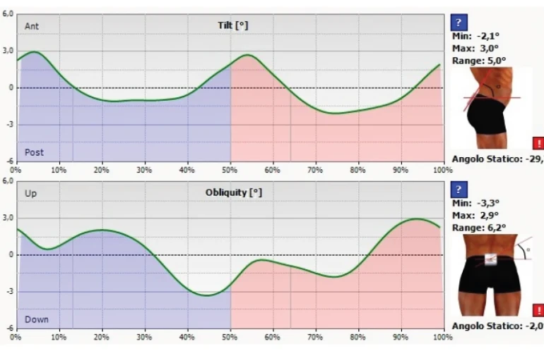 Elettronica del sensore
